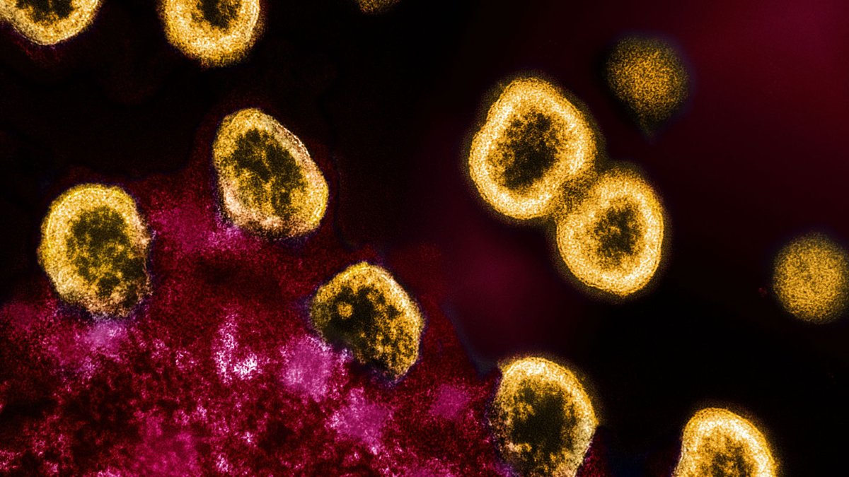 ‘Dormant’ #HIV has ongoing skirmishes with the body’s immune system tinyurl.com/2cad9fne