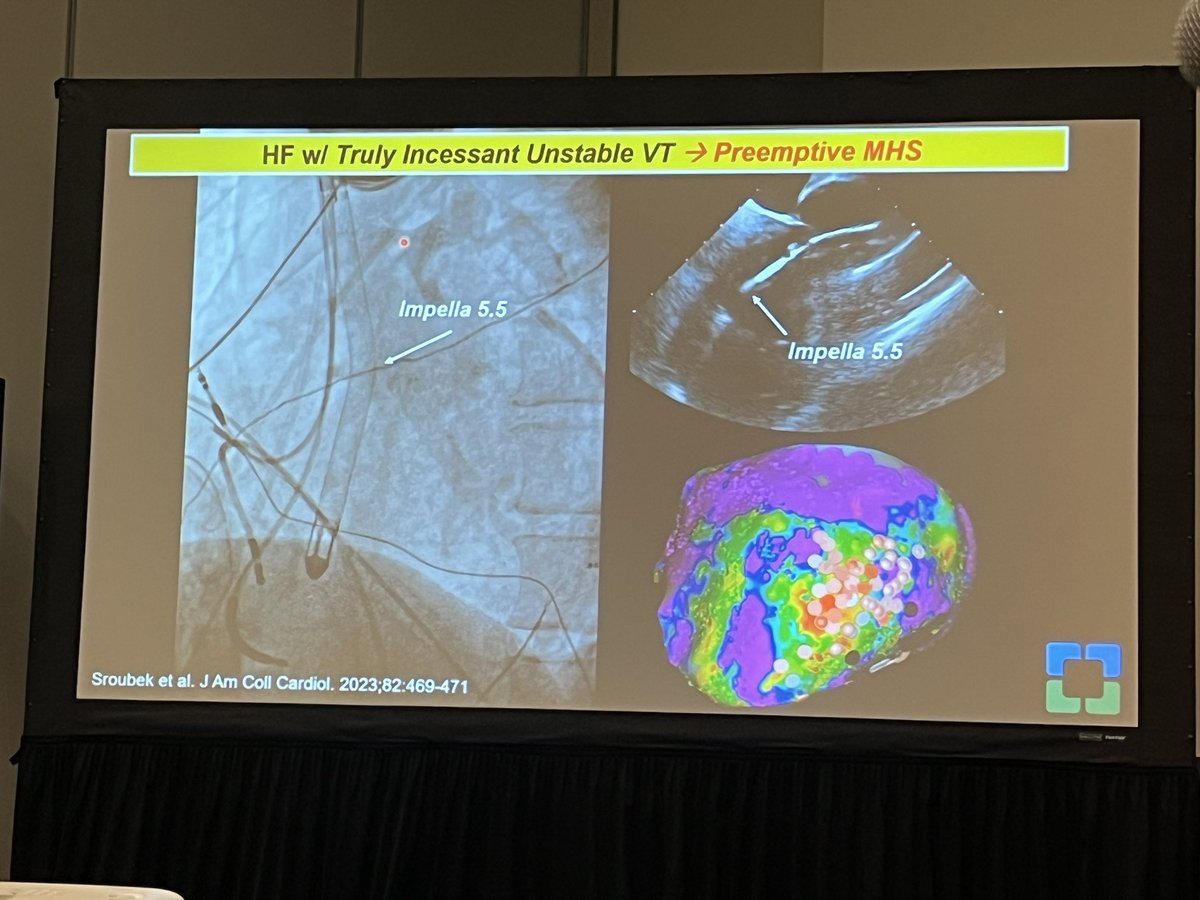 Great @CleClinicHVTI EP representation with @Dr_Santangeli and @DrJustinZLee discussing EP rhythm strategies for HF patients, covering the role of #ablation for both AF and VT in our patient population #HFSA2023 @HFSA @CCFcards @omwazni @tavrkapadia @venumenon10 @LarsSvenssonMD