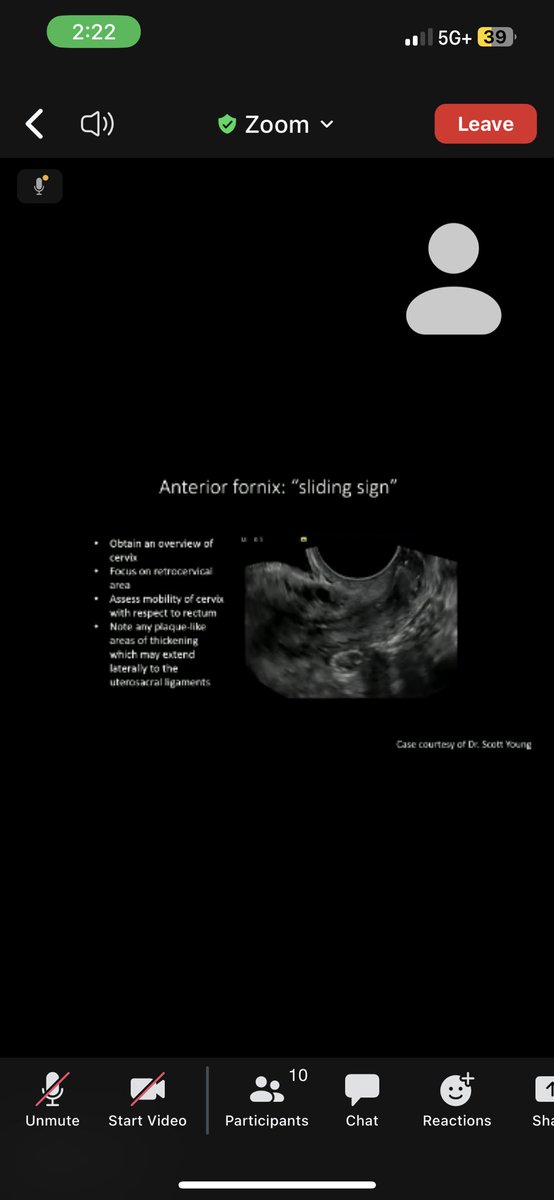 I will be at #SABI2023 tomorrow but I’m enjoying the ultrasound session remotely for now. Uninterrupted learning!! Great session by <a href="/DTFetzer/">David T. Fetzer</a> <a href="/WendalineVB/">Wendaline VanBuren</a> <a href="/ayakamaya/">Aya Kamaya, MD</a> <a href="/EdneyElizabeth/">Elizabeth A Edney</a> and Dr. Rogers. <a href="/SABImaging/">Society for Advanced Body Imaging | SABI</a>