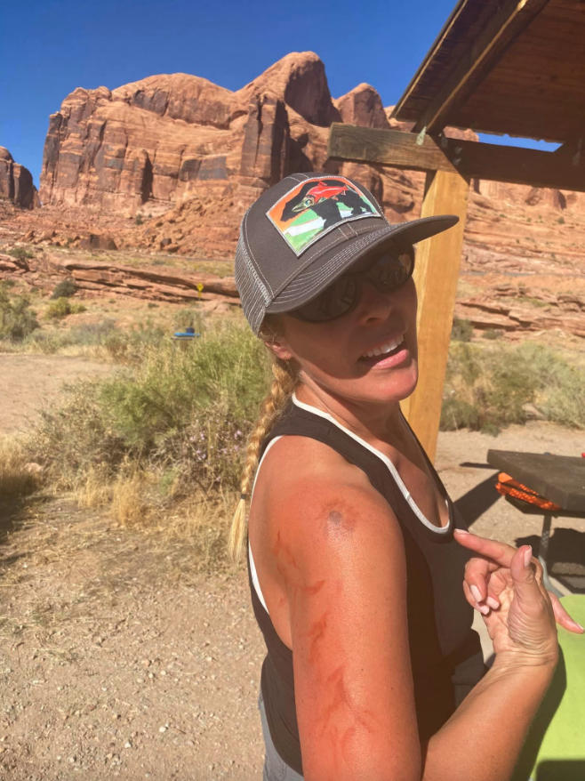 JacksonHoleRose's tweet image. Just returned from the backcountry! Now that I've passed all my tests &amp;amp; am officially a Wilderness First Responder, I'm proud to say I could save a life from a more serious complication 🏥

#jacksonhole #woofer