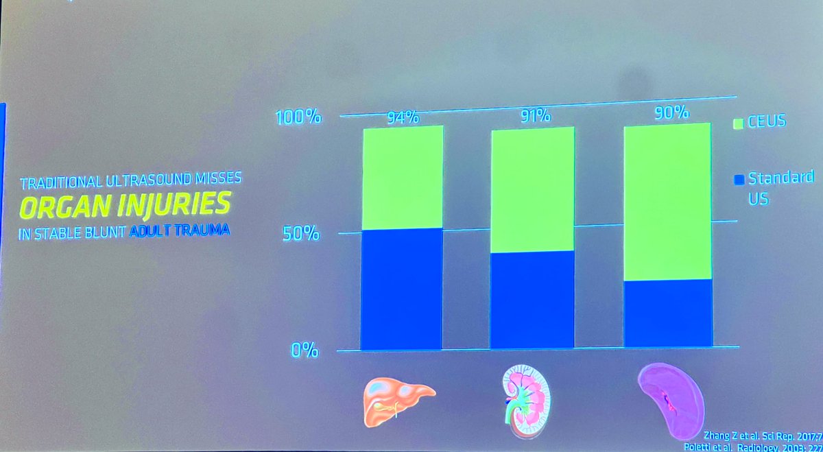 Do you know what contrast US looks like? It improves detection of solid organ injuries. Maybe a good adjunct to your FAST exam? Dr.Kummer explains at #EUMC #ACEP23