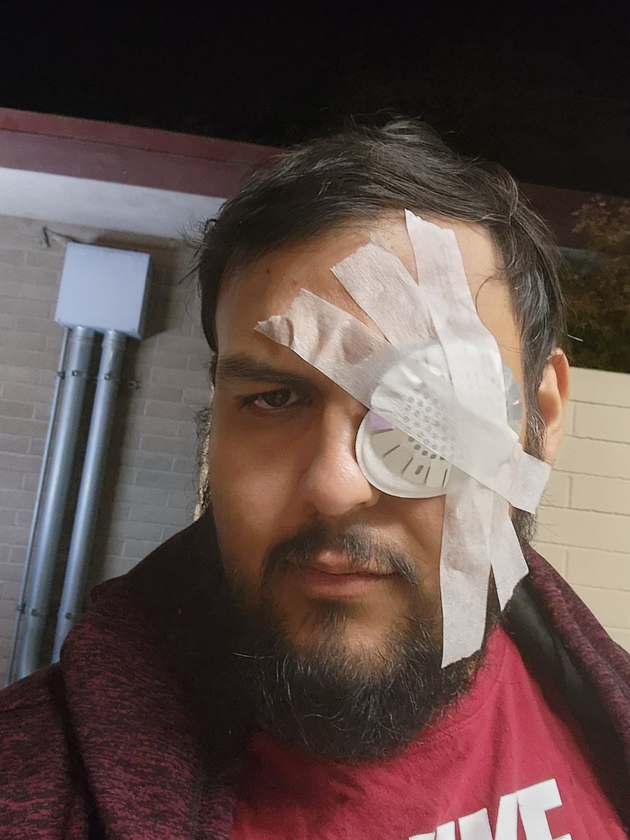 Ant_Hs's tweet image. This is what I get after going to the ER last night and leaving with an eye patch. It does kinda go hard tho @TreMetal best artist