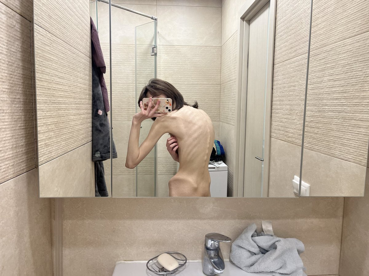 bugsinthericepd's tweet photo. ꒰ა lera’s intro ໒꒱                  ⋆｡°✩

16 ♡ rus/eng    
ana-r (in recovery)         ⠀:¨ ·.· ¨: 
                                             `· . ୨୧⠀ 
not pro ana/fatphobic 
lowest bmi: 10.8 
🏩 x4                                 ໒꒰ྀི  ◞ ◟꒱ྀིა https://t.co/Rn8rpB1xwy