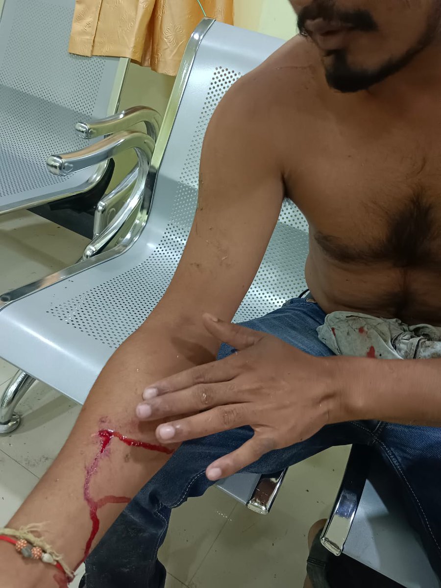 Rakesh chakravorty (@rakeshchakravo) on Twitter photo We condemn the attack on NSUI worker Jaiprakash Das by ABVP activists while returning from "Youth Jodo Yatra" of Assam Pradesh Youth Congress at Karimganj.
<a href="/srinivasiyc/">Srinivas BV</a> <a href="/IYC/">Indian Youth Congress</a> <a href="/IYCAssam/">Assam Pradesh Youth Congress</a>
<a href="/Zubairanam/">Zubair Anam</a> <a href="/BhupenKBorah/">Bhupen kumar Borah</a> <a href="/GauravGogoiAsm/">Gaurav Gogoi</a> @allavaru We condemn the attack on NSUI worker Jaiprakash Das by ABVP activists while returning from "Youth Jodo Yatra" of Assam Pradesh Youth Congress at Karimganj.
<a href="/srinivasiyc/">Srinivas BV</a> <a href="/IYC/">Indian Youth Congress</a> <a href="/IYCAssam/">Assam Pradesh Youth Congress</a>
<a href="/Zubairanam/">Zubair Anam</a> <a href="/BhupenKBorah/">Bhupen kumar Borah</a> <a href="/GauravGogoiAsm/">Gaurav Gogoi</a> @allavaru