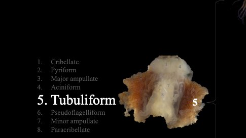 CorreaGarhwal's tweet photo. @AAS_arachnology There are so many tubulliform silk glands that I think - Likely Tubulliform mixed with aciniform and a dash of pyriform. Of course, there is always something else! Let's celebrate #DeinopidDay https://t.co/raBB5cdV6O