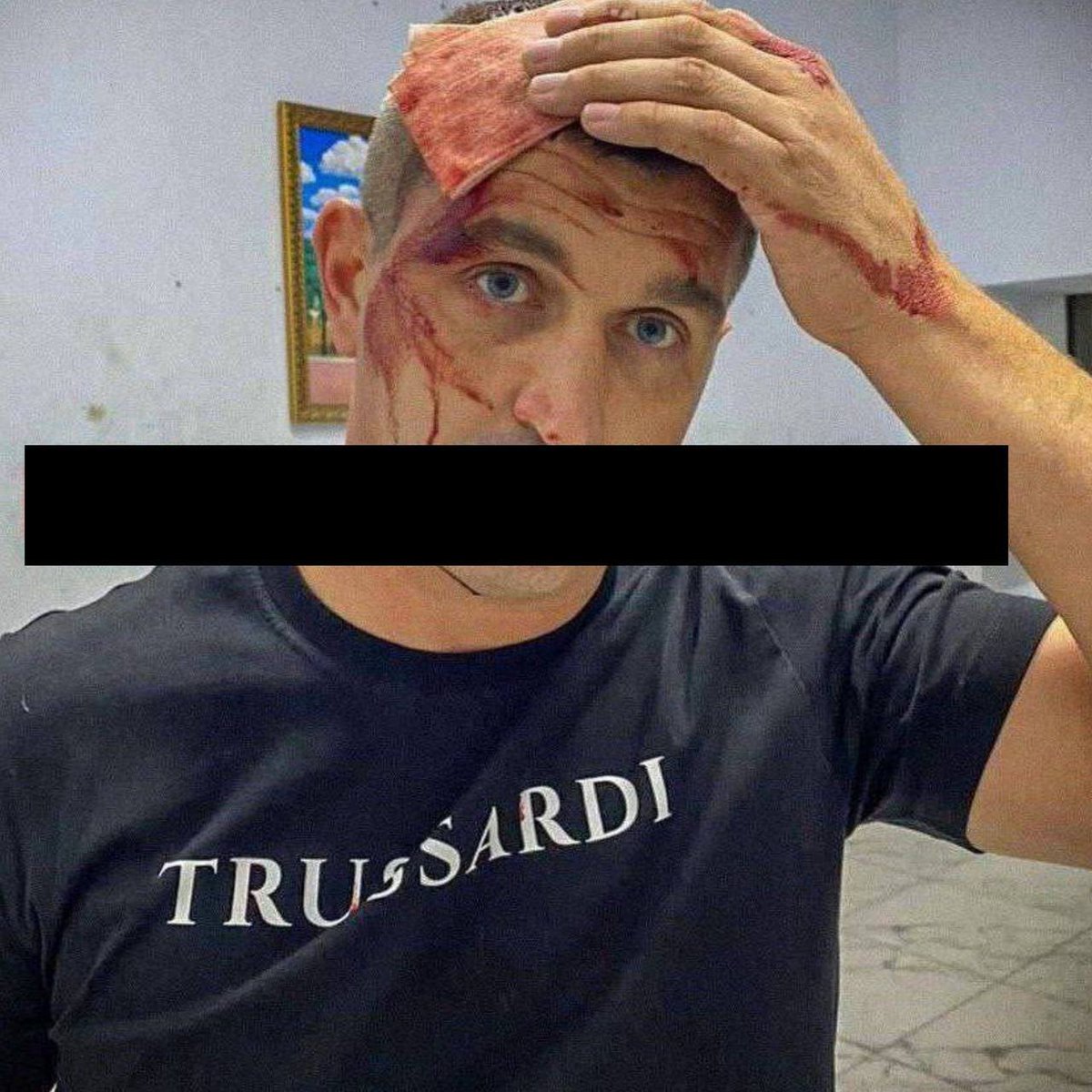 khpg's tweet photo. In Mariupol, unknown persons hit a Russian politician on the head with a crowbar, the Mariupol City Council reports.
In his opinion, it was done by the 'waiters', as he called the Mariupol residents who are waiting for the city to return to Ukraine.
📷 Mariupol City Council https://t.co/jB6Itvy5Cp