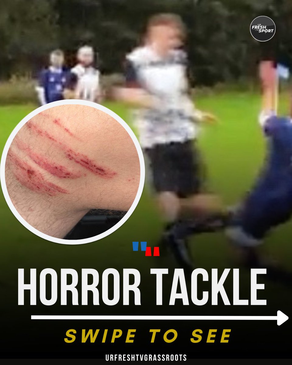 urfreshtv_sport's tweet photo. HORROR TACKLE‼️😱

How do we ensure players safety whilst playing Sunday League football? 

This is quite easily a leg breaker &amp; apparently isn’t the first time he’s made a tackle like this, can the FA hand out retrospective punishment at Sunday League level? 

♻️ @gws_coaching https://t.co/m6GiAptVcq