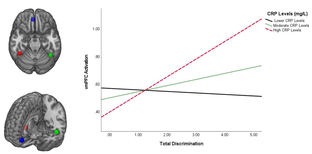 Negar Fani (@negarfani) on Twitter photo Proud of <a href="/ElbasheirAziz/">Aziz Elbasheir</a> for his <a href="/npp_journal/">Neuropsychopharmacology</a> π¨ showing inflammation as a mechanism through which racial trauma can affect neural networks--an impactful collaboration with <a href="/BIEmory/">Emory Behavioral Immunology Program</a> leader Dr. Felger and #gradytraumaproject team! <a href="/EmoryBrain/">EmoryBrainHealth</a> Proud of <a href="/ElbasheirAziz/">Aziz Elbasheir</a> for his <a href="/npp_journal/">Neuropsychopharmacology</a> π¨ showing inflammation as a mechanism through which racial trauma can affect neural networks--an impactful collaboration with <a href="/BIEmory/">Emory Behavioral Immunology Program</a> leader Dr. Felger and #gradytraumaproject team! <a href="/EmoryBrain/">EmoryBrainHealth</a>