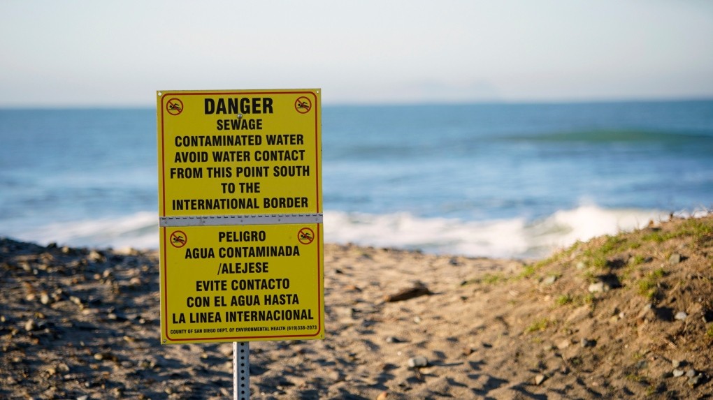 CaraSantaMaria's tweet photo. Beaches are nice, the pathogenic bacteria not so much. 

#Beaches #NorthernBeaches #PublicHealth #Ocean #PathogenicBacteria #OceanBacteria #Health 

https://t.co/vwCgWFoPgT via @nytimes https://t.co/saRv3a47ul
