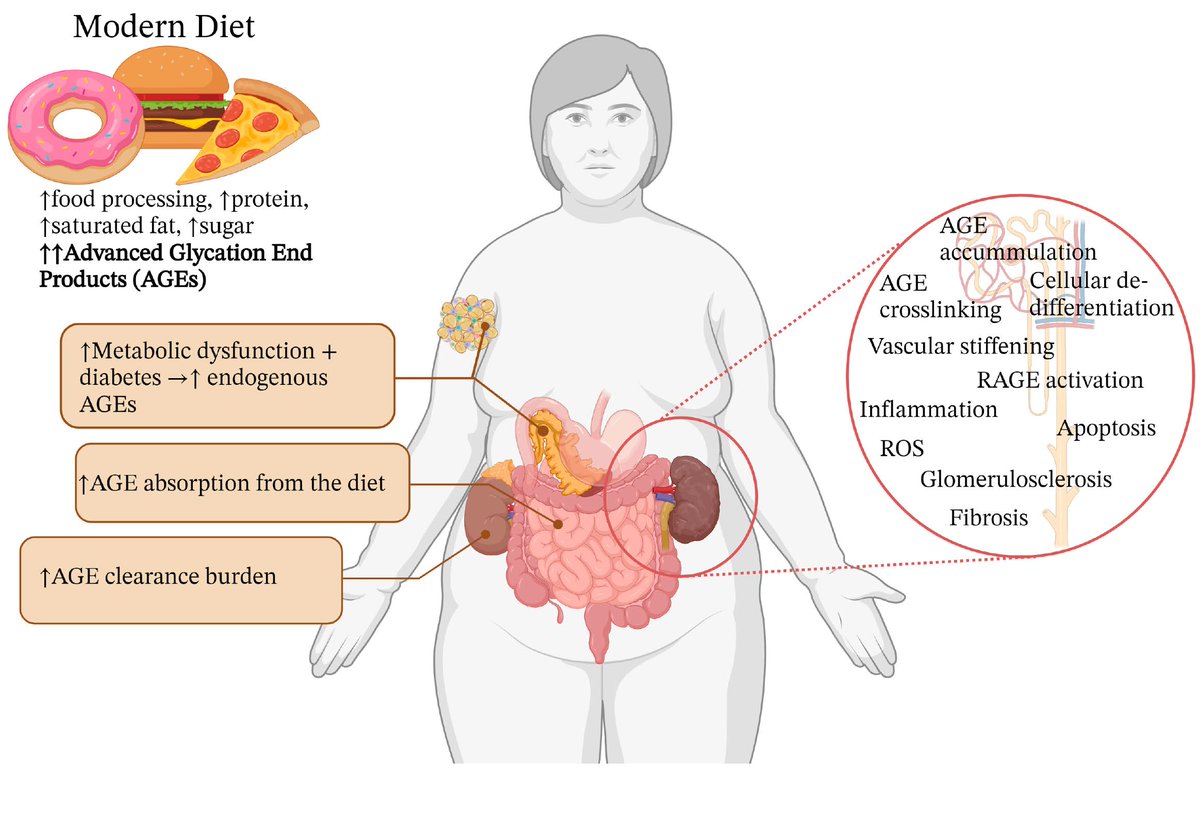 Editor’s Choice Article🔍
🛎️"Advanced Glycation End Products (AGEs) and Chronic Kidney Disease:Does the Modern Diet AGE the Kidney?" by Prof. Josephine M Forbes et al.<a href="/DrDanBorg/">Danielle Borg</a> <a href="/TRI_info/">Translational Research Institute</a> <a href="/LindaAGallo/">Linda Gallo</a> <a href="/UQMedicine/">UQ Medicine</a> <a href="/HealthTQld/">Health Translation Queensland</a> <a href="/DrPalmquist/">DrRPalmquist</a> <a href="/M3xico3nl4b4nC4/">Manuel Villegas</a>
👉mdpi.com/2072-6643/14/1…