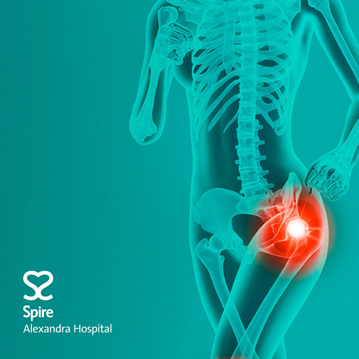SpireAlexandra's tweet photo. Is your hip causing you pain? 

Well, this autumn we are offering a series of free mini consultations or Q&amp;A sessions with expert orthopedic consultants. 📆 

View our upcoming events ➡️ https://t.co/23jfnwk23s or call ☎️ 01634 662866 https://t.co/4FEGFZqCOT