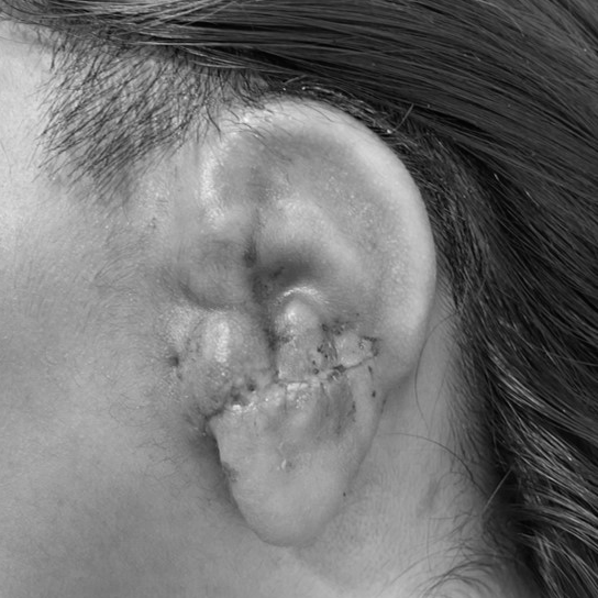 FabLab 3D Hospital Marañón (@3d_maranon) on Twitter photo Anatomical model of the complete skull (CMD Class I) in case of microtia due to left hemifacial microsomia. The anatomical model allows surgeons to plan the reconstruction of the left pinna.
<a href="/3d_maranon/">FabLab 3D Hospital Marañón</a> <a href="/rupermac/">Rubén Pérez-Mañanes, MD PhD</a> <a href="/calvoharo_ja/">José Antonio Calvo</a> #UPAM3D #HospitalGreorioMarañon #impresion3d Anatomical model of the complete skull (CMD Class I) in case of microtia due to left hemifacial microsomia. The anatomical model allows surgeons to plan the reconstruction of the left pinna.
<a href="/3d_maranon/">FabLab 3D Hospital Marañón</a> <a href="/rupermac/">Rubén Pérez-Mañanes, MD PhD</a> <a href="/calvoharo_ja/">José Antonio Calvo</a> #UPAM3D #HospitalGreorioMarañon #impresion3d