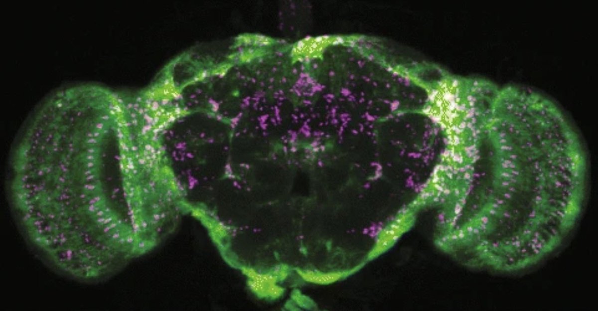BIOLOGY/BMS External Seminar - Dr Nathan Woodling @NathanWoodling @UofGlasgow - Untangling glial and neuronal signalling in ageing and dementia. Wednesday October 4th, 1-2 pm, BMS Seminar Room RM001. Hosted by @FGunnMoore 📸PMID: 32928209