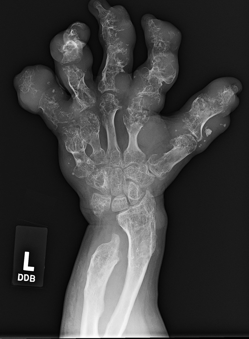 UW MSK Imaging & Intervention tweet media