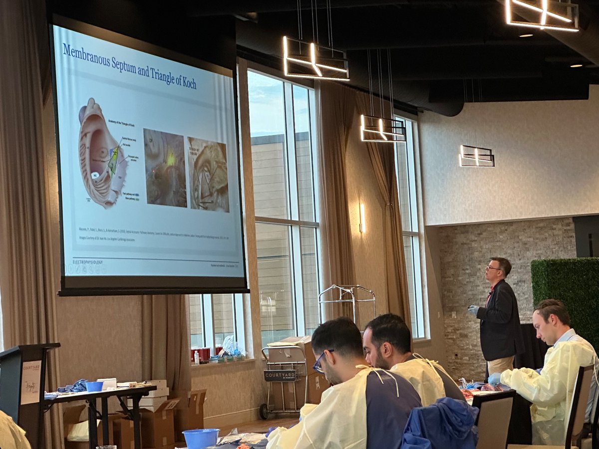 Univ of Iowa Cardiovascular Fellowship Program (@uiowacvfellows) on Twitter photo Last evening, UIowa Electrophysiologist Dr.Sam Johnston led a fantastic heart dissection event sponsored by Abbott. It was a great opportunity for our fellows to directly observe cardiac anatomy! <a href="/AbbottCardio/">Abbott Cardiovascular</a> Last evening, UIowa Electrophysiologist Dr.Sam Johnston led a fantastic heart dissection event sponsored by Abbott. It was a great opportunity for our fellows to directly observe cardiac anatomy! <a href="/AbbottCardio/">Abbott Cardiovascular</a>