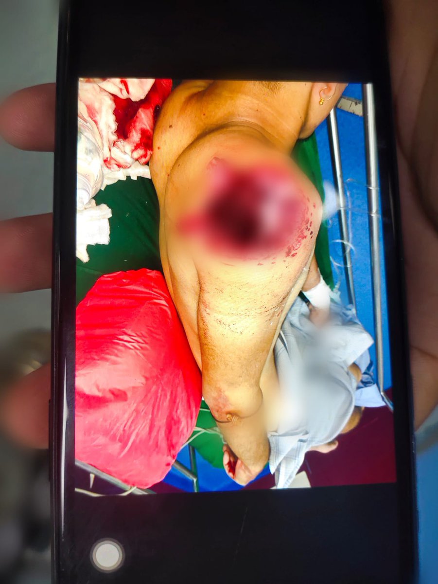 Nongshaba164763's tweet photo. Congratulations, 👏@official_dgar @Spearcorps You have succeeded in damaging these students' futures and handicapping them for a lifetime. What did they do wrong? They were only seeking justice. It's not wrong if people label you MONSTER. #Imphal #Manipur #StudentsLifeMatter https://t.co/CovXGLhsvt