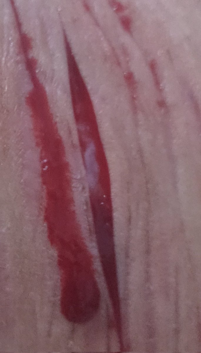 shmimi009's tweet photo. Only styro :( https://t.co/ea0LnOpzLj