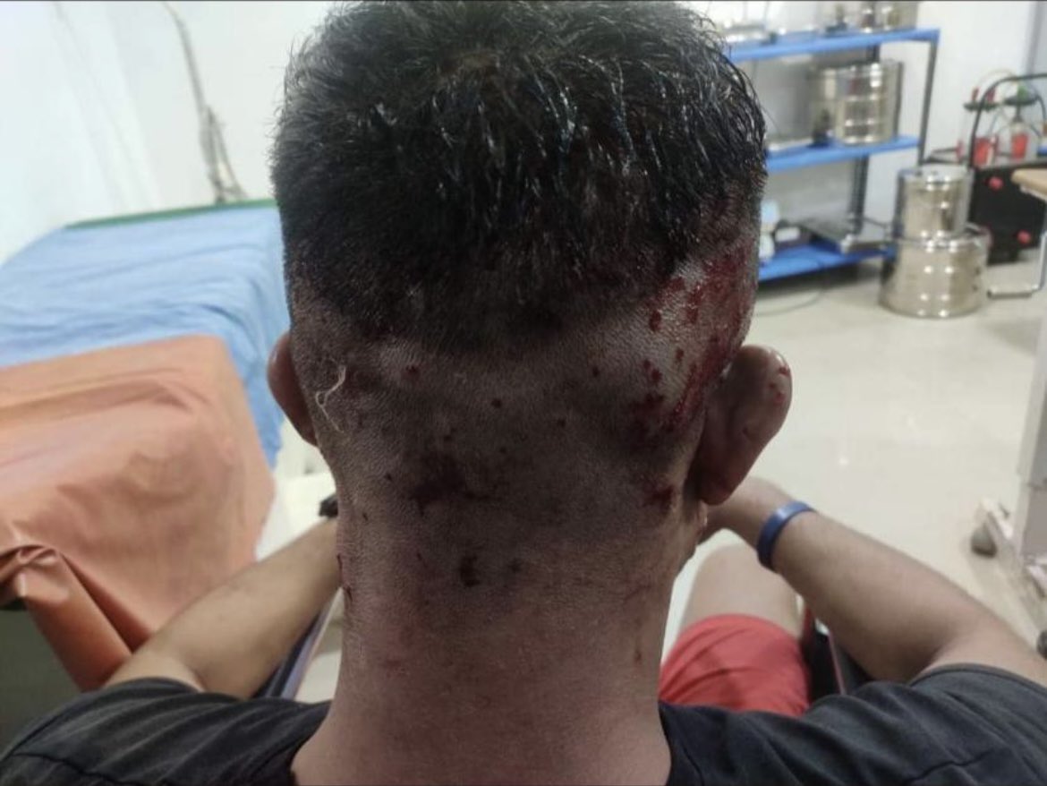 LishCh's tweet photo. #IndianArmy Oh! This is how they control Mob by using shotgun. 
Shri @narendramodi  @AmitShah  #WeWantAnswers. 
Two of them are in critical condition.
#SaveMeiteis 
@BBCBreaking @ndtv @cnnbrk @timesofindia @ABPNews @manipurnewshour @IndiaToday @Outlookindia @adgpi @PMOIndia https://t.co/nlE402fmxC