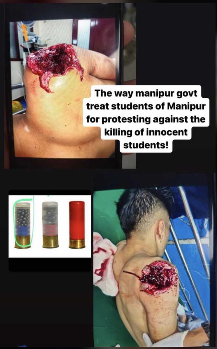 LishCh's tweet photo. #IndianArmy Oh! This is how they control Mob by using shotgun. 
Shri @narendramodi  @AmitShah  #WeWantAnswers. 
Two of them are in critical condition.
#SaveMeiteis 
@BBCBreaking @ndtv @cnnbrk @timesofindia @ABPNews @manipurnewshour @IndiaToday @Outlookindia @adgpi @PMOIndia https://t.co/nlE402fmxC