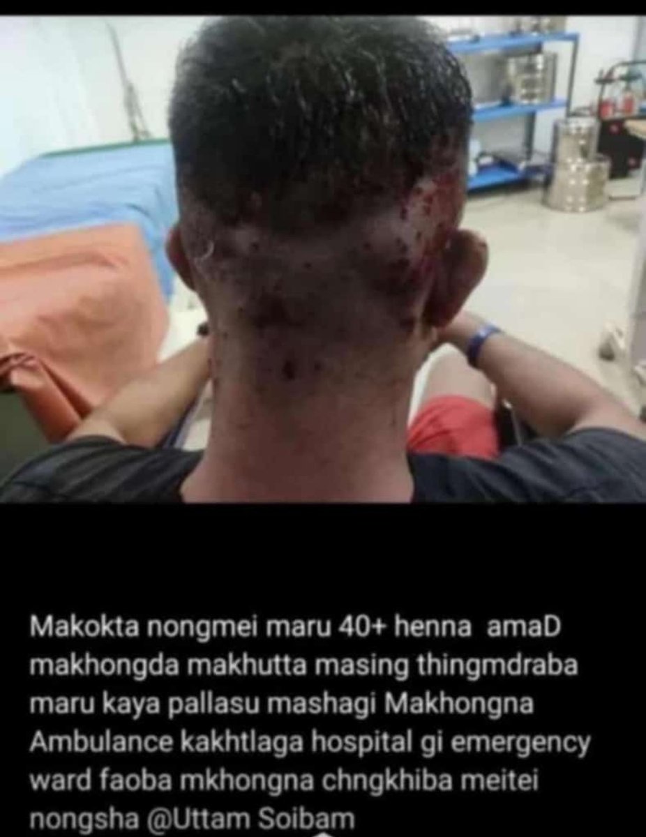lmutum's tweet photo. This is the result of shooting kartoos bullet on unarmed student by indian central forces today at Imphal ? Is this really necessary? Their incapability to save two student being killed by #KukiNarcoTerrorists is reflected on their aggression on protestors protesting against it. https://t.co/1A3Vp4FC8a