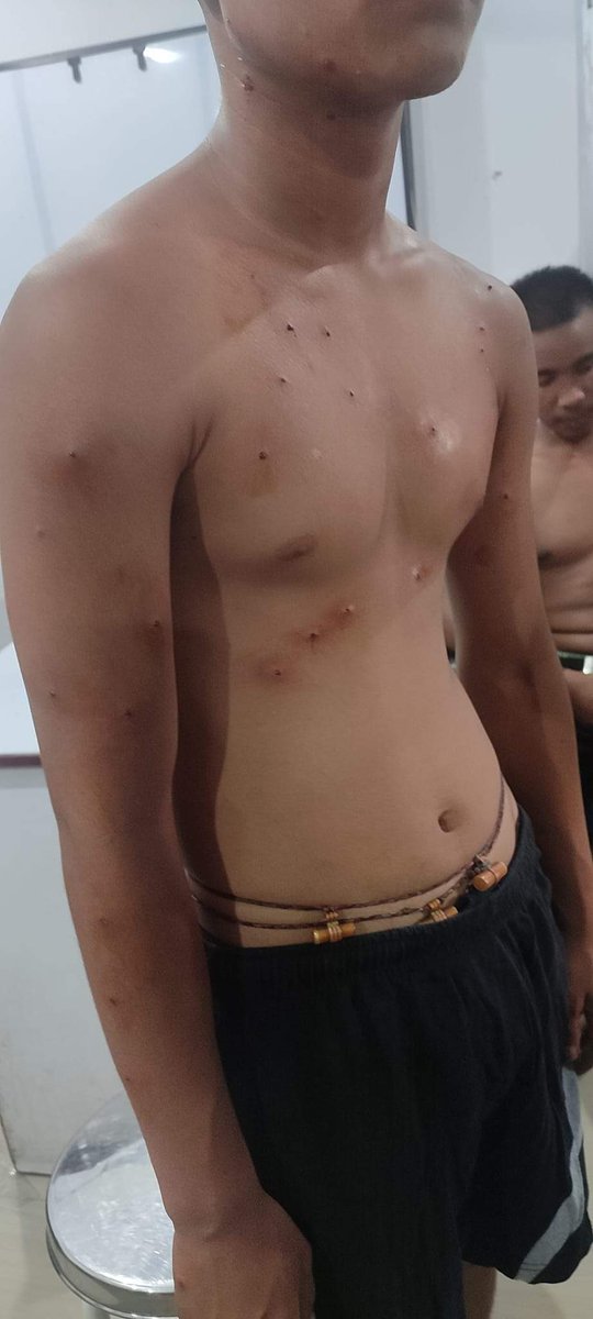 SumaSapam's tweet photo. #ManipurRiots #ManipurViolence #ManipurDemandsJustice #KukiTerr0rists See this what they have done to the innocent students @PMOIndia @AmitShah what are the central forces for did u send them to hurt us https://t.co/0K7ULn8BxQ