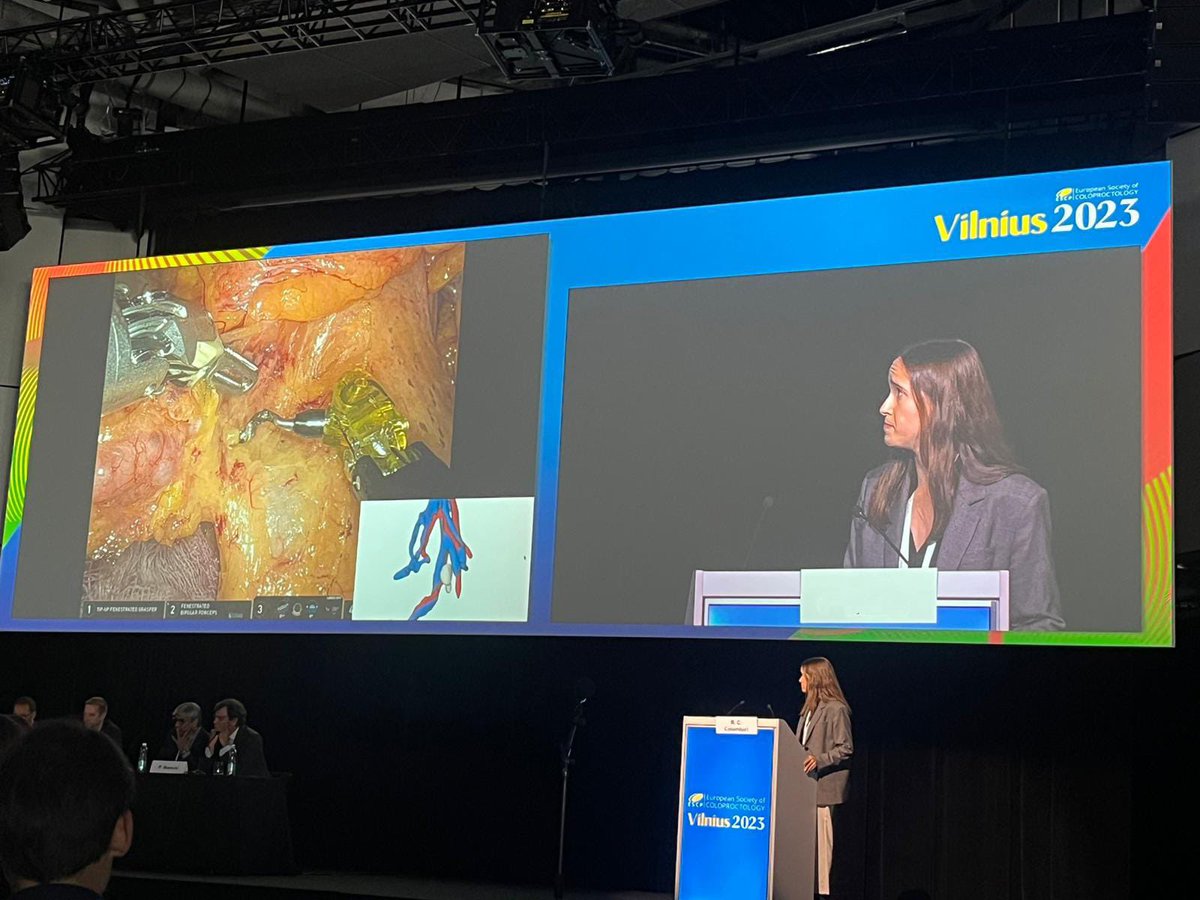 María Sánchez-Rodríguez (@merysanchezro) on Twitter photo Today, we have presented a video about the “Utility of preoperative planning with 3D vascular reconstruction, prior to D3 right colectomy” at #ESCP2023 <a href="/escp_tweets/">European Society of Coloproctology</a> 🤓😍 Special thanks to <a href="/RenanColombari/">Renan Colombari</a> <a href="/TejedorPat/">Pat Tejedor</a> <a href="/ColoproctoHGUGM/">Coloproctología HGU Gregorio Marañon</a> for give me the opportunity to share our work. Today, we have presented a video about the “Utility of preoperative planning with 3D vascular reconstruction, prior to D3 right colectomy” at #ESCP2023 <a href="/escp_tweets/">European Society of Coloproctology</a> 🤓😍 Special thanks to <a href="/RenanColombari/">Renan Colombari</a> <a href="/TejedorPat/">Pat Tejedor</a> <a href="/ColoproctoHGUGM/">Coloproctología HGU Gregorio Marañon</a> for give me the opportunity to share our work.