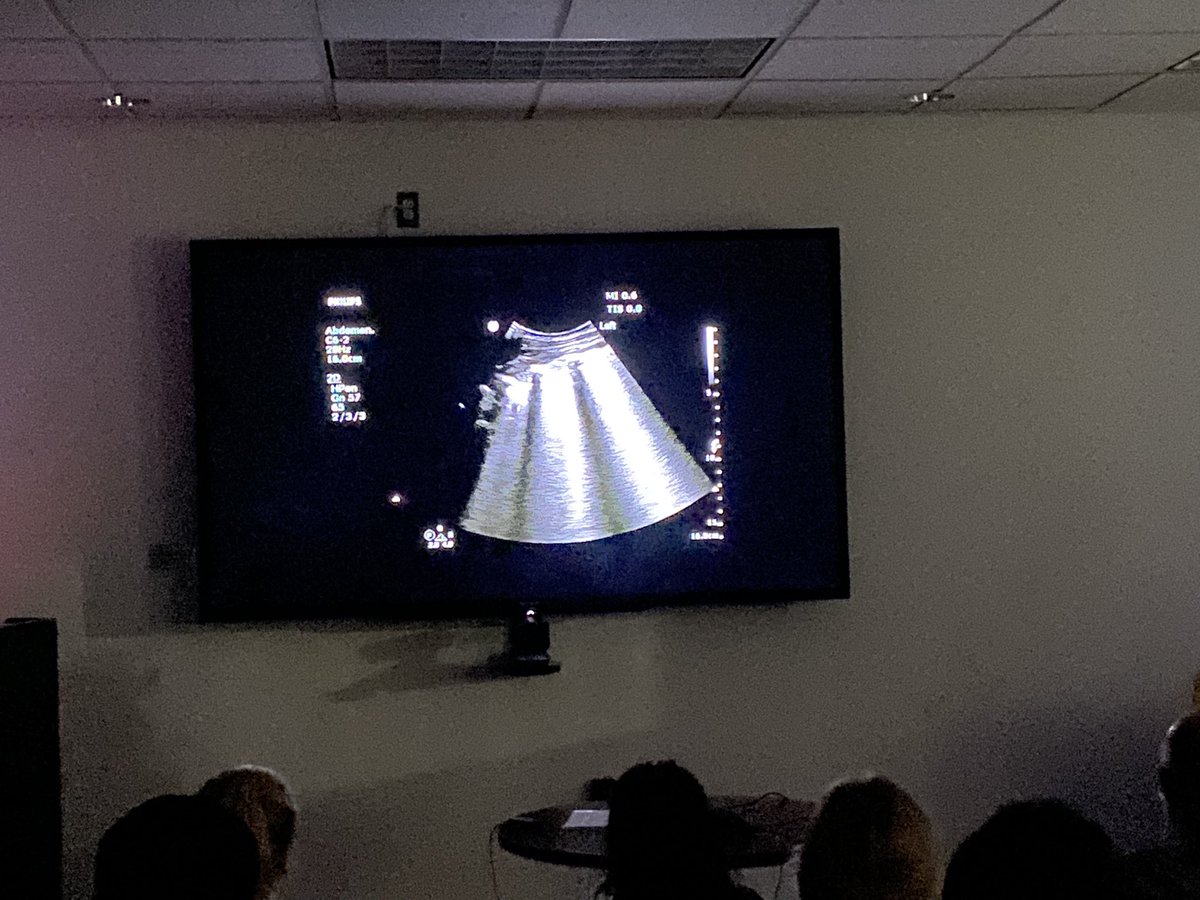MH/CCF/CWRU Emergency Medicine Residency (@metrohealth_em) on Twitter photo Halloween prep!  #emconf respiratory theme continues with #lung #POCUS and a #hocuspocus Q and A by @CLE_sonoB.  Quiz show in the dark!  #Alines #blines #shredsign #lungpoint #airbronchograms #embound @CleClinicESI Halloween prep!  #emconf respiratory theme continues with #lung #POCUS and a #hocuspocus Q and A by @CLE_sonoB.  Quiz show in the dark!  #Alines #blines #shredsign #lungpoint #airbronchograms #embound @CleClinicESI