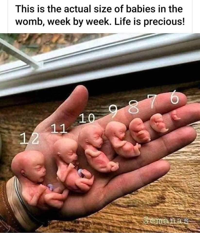 Susan (@emma6usa) on Twitter photo I AM PROLIFE
<a href="/PSwal807/">Penny Calls a Lid 🇺🇸🇮🇹</a>
@CJSzx12
@genuke1
<a href="/fordmb1/">fordnGA777 ✝️✡️✝️</a>
<a href="/LsgaMike/">LSGAMike</a>
<a href="/gildea_leo/">Leo</a>
<a href="/Chloe4Djt/">🇺🇸 CHLOE 🇺🇸</a>
<a href="/CaliRN619/">CaliRN619 🚑🩺🚑</a>
<a href="/Rammie24/">🐏RAMMIE🐏</a>
<a href="/thames_tim/">Just a Redneck From The South</a>
<a href="/PatriotInSF/">Mad Starr</a>
<a href="/Corgi_MAGA/">Misha O’Brien - IFBAP</a>
<a href="/SallyBoop309/">Sally</a>
<a href="/GaryWalters66/">Gary Walters</a>
<a href="/yorkiemomma4/">Vindi 💜💜</a>
<a href="/pokergod12345/">~Pokergod~ #AbolishtheNYTimes MAGA 2024</a>
<a href="/JacobiteRebel46/">Jacobite</a>
<a href="/heyitsmeCarolyn/">꧁♛𝓑𝓵✯𝓷𝓭𝓲𝓮𝓼♛꧂</a>
<a href="/HoseMonster2024/">🚒Steve 2A🇺🇸GodFamilyCountry🇺🇸</a>
<a href="/emma6USA/">Susan</a>🦅 I AM PROLIFE
<a href="/PSwal807/">Penny Calls a Lid 🇺🇸🇮🇹</a>
@CJSzx12
@genuke1
<a href="/fordmb1/">fordnGA777 ✝️✡️✝️</a>
<a href="/LsgaMike/">LSGAMike</a>
<a href="/gildea_leo/">Leo</a>
<a href="/Chloe4Djt/">🇺🇸 CHLOE 🇺🇸</a>
<a href="/CaliRN619/">CaliRN619 🚑🩺🚑</a>
<a href="/Rammie24/">🐏RAMMIE🐏</a>
<a href="/thames_tim/">Just a Redneck From The South</a>
<a href="/PatriotInSF/">Mad Starr</a>
<a href="/Corgi_MAGA/">Misha O’Brien - IFBAP</a>
<a href="/SallyBoop309/">Sally</a>
<a href="/GaryWalters66/">Gary Walters</a>
<a href="/yorkiemomma4/">Vindi 💜💜</a>
<a href="/pokergod12345/">~Pokergod~ #AbolishtheNYTimes MAGA 2024</a>
<a href="/JacobiteRebel46/">Jacobite</a>
<a href="/heyitsmeCarolyn/">꧁♛𝓑𝓵✯𝓷𝓭𝓲𝓮𝓼♛꧂</a>
<a href="/HoseMonster2024/">🚒Steve 2A🇺🇸GodFamilyCountry🇺🇸</a>
<a href="/emma6USA/">Susan</a>🦅