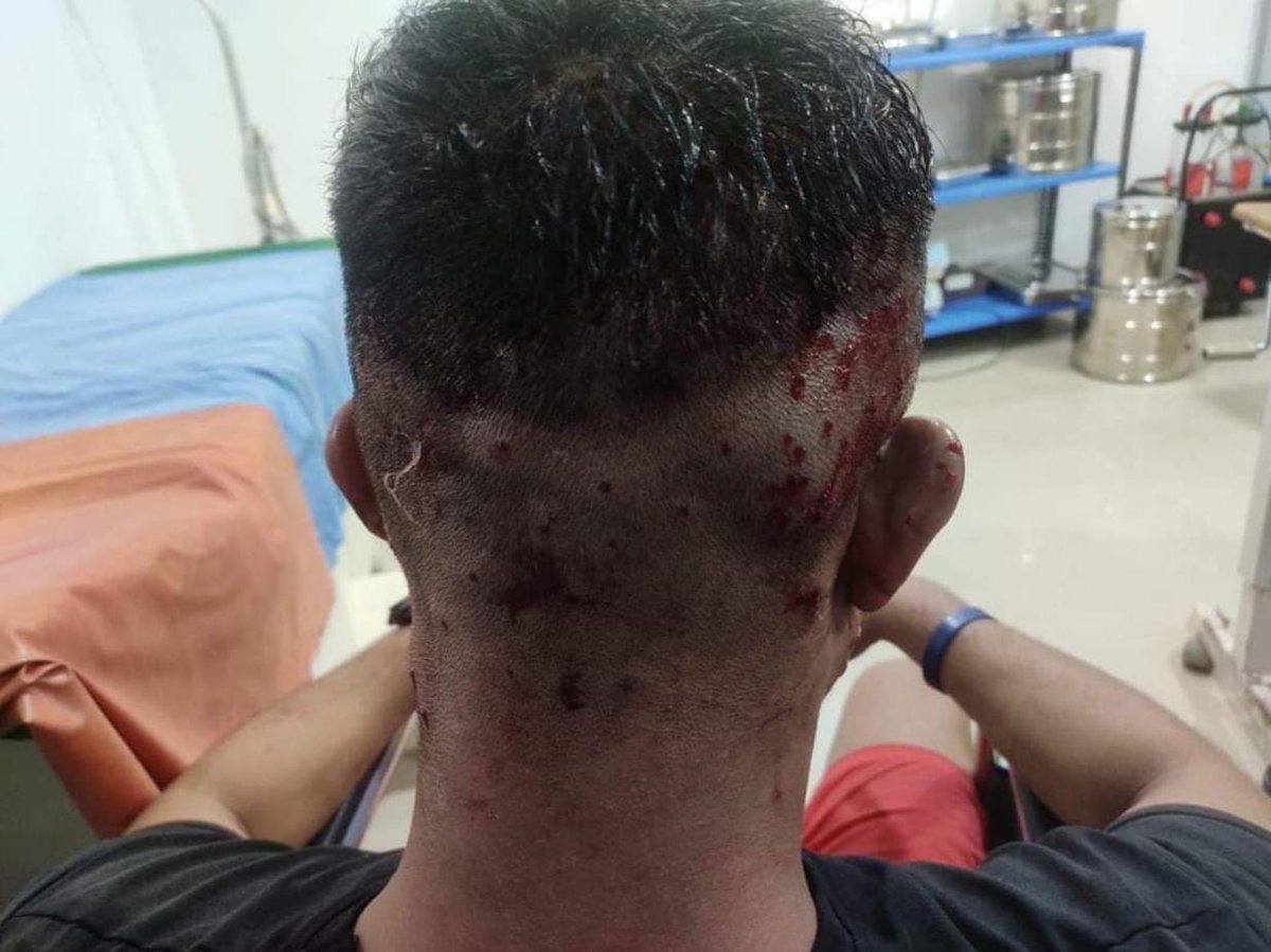 PELLET  GUNS used to disperse school students who were demanding justice for #Linthoingambi &amp; #Hemanjit. 
#Manipur #ManipurDemandsJustice #ManipurFightsBack