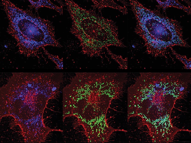 BPoD_s's tweet photo. ROS vs Bacteria: Inducing lung lining cells to produce bacteria-killing #reactiveoxygenspecies protects against #pneumonia without reliance on #antibiotics. Image &amp; research by Yongxing Wang et al @ScottEvansMD lab @MDAndersonNews in @PLOSPathogens. On https://t.co/I8EdJEFmbb https://t.co/nUhLmKo3oX