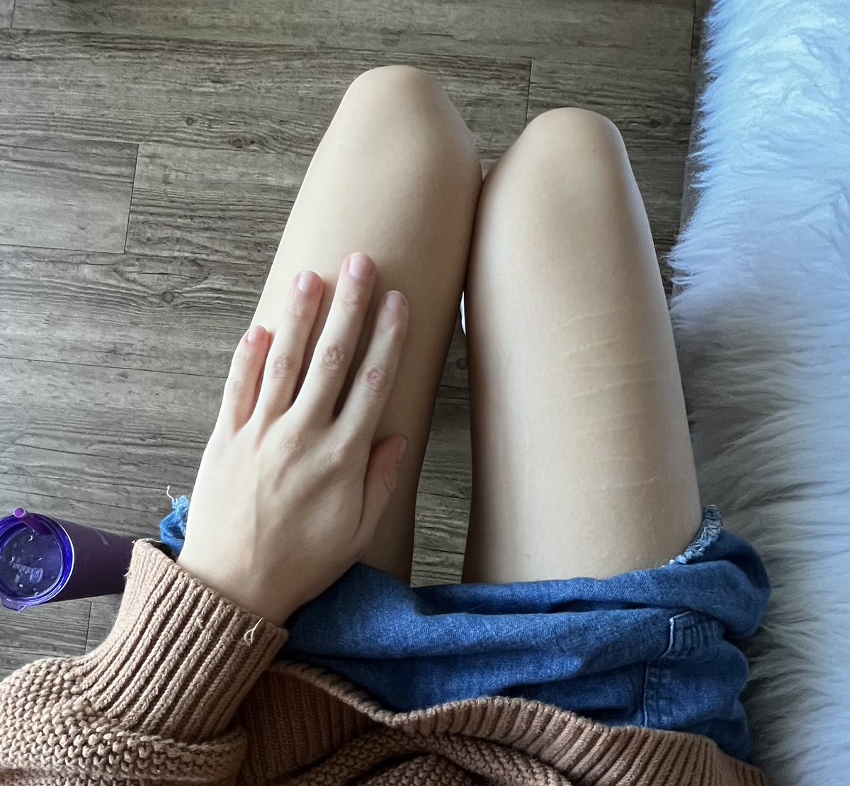 lileddiary's tweet photo. Then —> Now, my skin pigment said goodbye https://t.co/qtyFqUFRd0