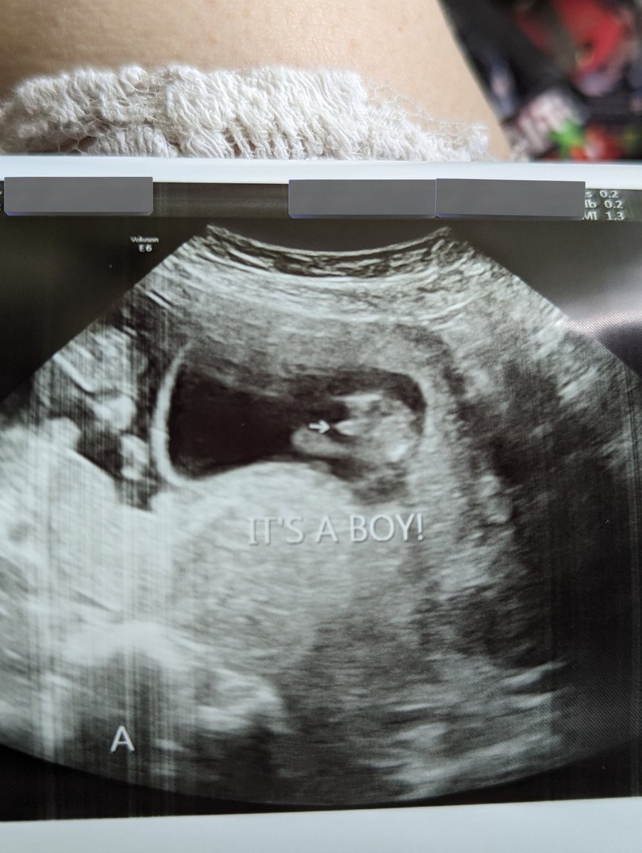 NellyNuttons's tweet photo. I have 2 little boys on the way!
One was napping, and the other was showing off the penis he just grew!
I'm a proud momma. https://t.co/kUQZ1BjQiL