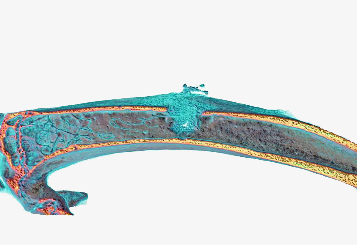 NEW LAB PAPER🚨 <a href="/lindseyremark/">Lindsey</a> in Nature Bone Research nature.com/articles/s4141… Notch signaling mutants amazingly show more bone🦴with age. This study can help us understand how to prevent skeletal degeneration! <a href="/PhilippLeuchtMD/">Philipp Leucht, MD</a> <a href="/kleclerc13/">Kevin Leclerc</a> <a href="/MargauxSambon/">Sambon Margaux</a> #orthotwitter #stemcells