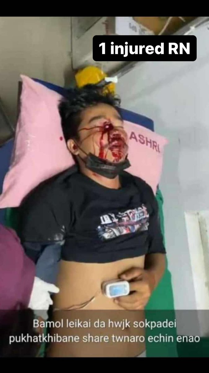 SumaSapam's tweet photo. See it your eyes wide open innocent people attacked by the forces who went for the rally and protest for the two dead soul #JusticeForLinthoigambi #JusticeForHemanjit #ManipurViolence #ManipurRiots #ManipurDemandsJustice #manipurfightsback #savemanipur @PMOIndia @AmitShah https://t.co/fb079EKDF8
