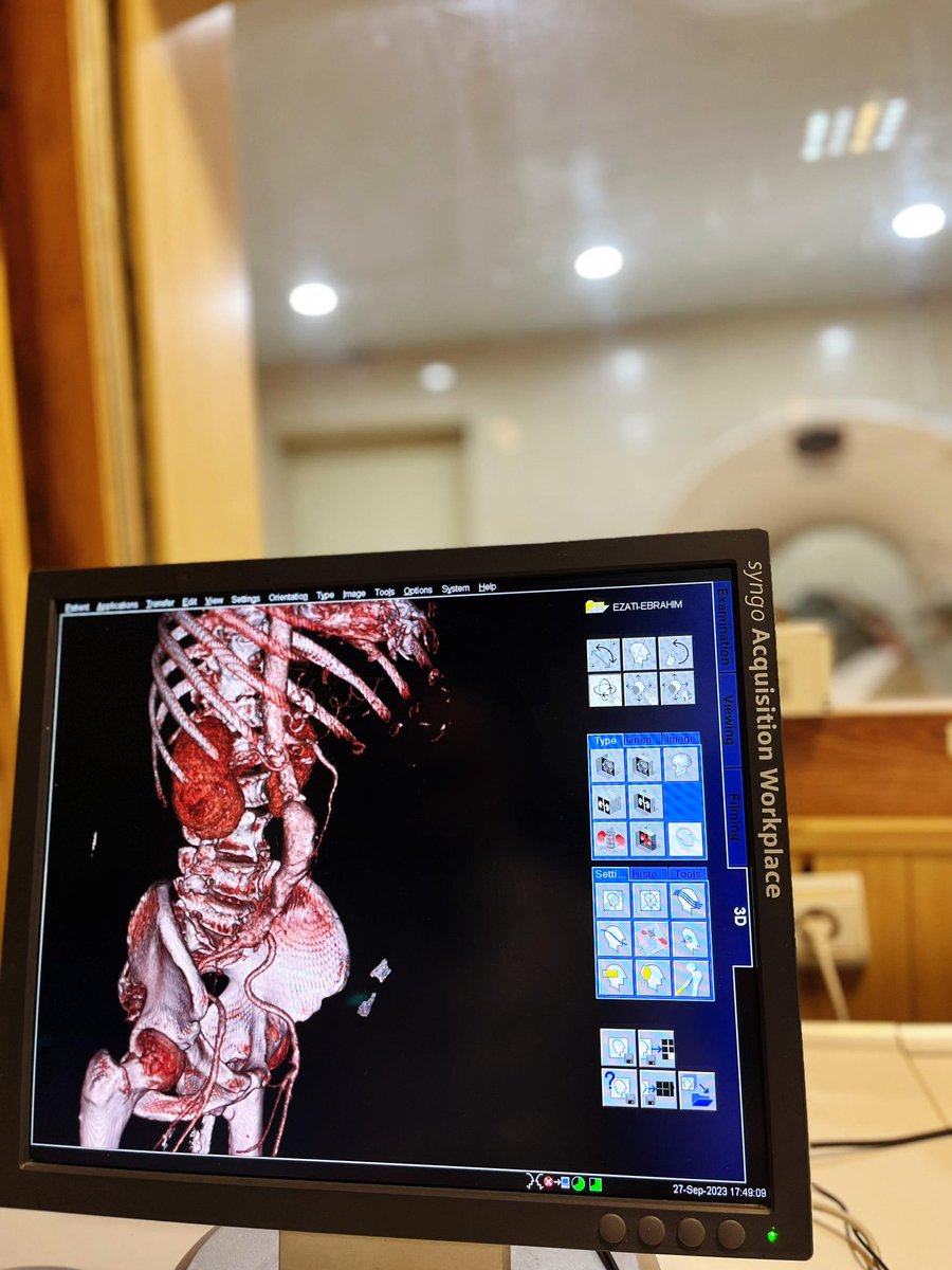 Abdominal aortic aneurysm!