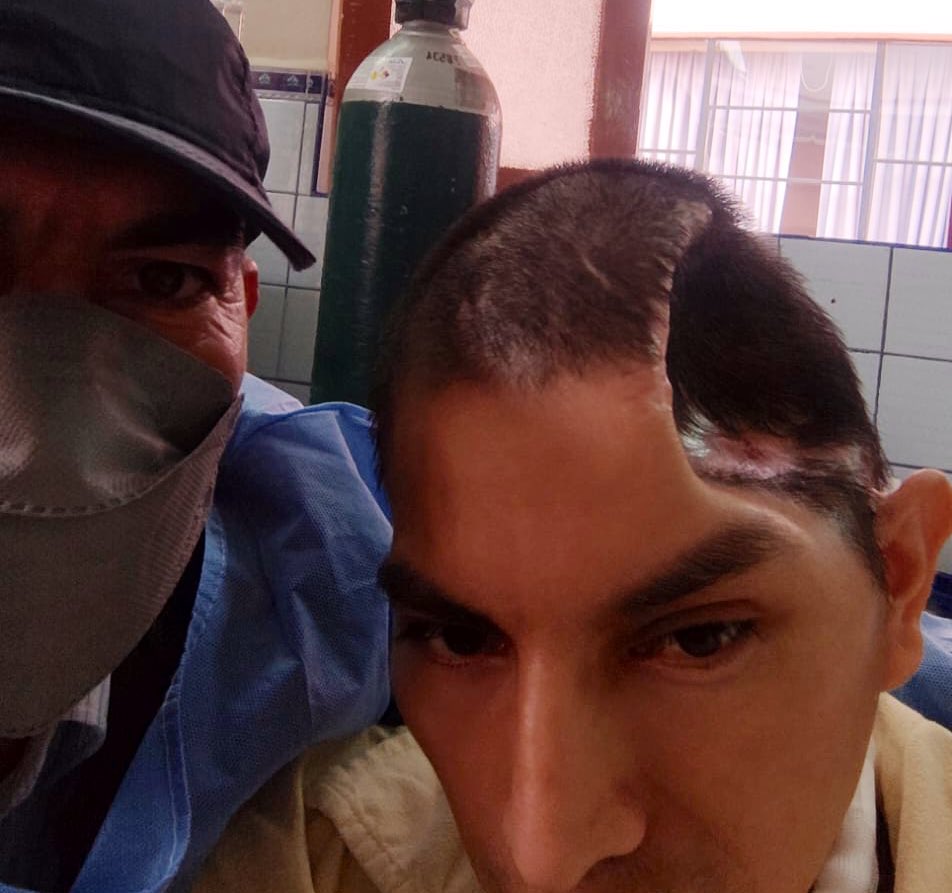 RuthLuqueIbarra's tweet photo. Así esta #RolandoMarcas, difundo esta imagen a pedido de su familia,quienes están desesperados x su salud y complicaciones. Indignante q heridos d este Gbno no reciban atención oportuna y eficiente. No es la 1ra vez q exijo,sus vidas importan @Minsa_Peru @pcmperu @AlbertoOtarolaP https://t.co/Th5ufVqpaL