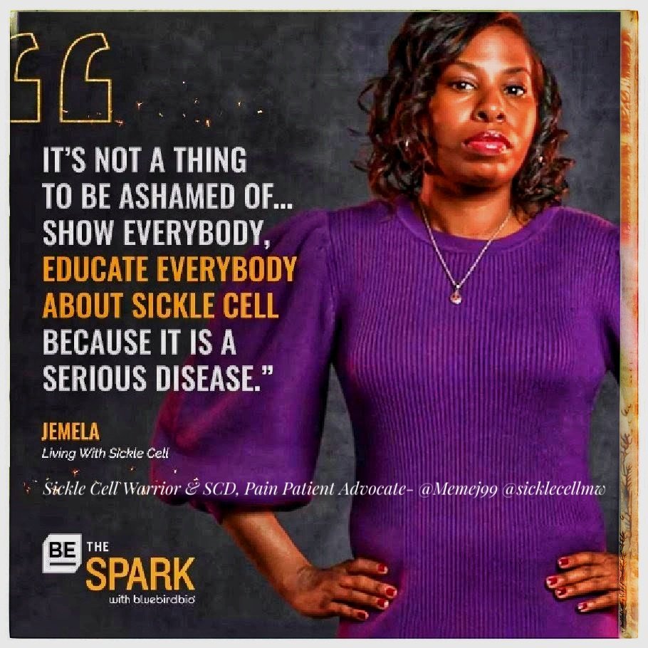 UEOSickleCell's tweet photo. As #SickleCellAwarenessMonth comes to a close, we're revisiting this moment in 2020 when TWO of our Board Members became a part of the @bluebirdbio's #BeTheSpark! We're proud to have 2 powerhouse #sicklecell warriors & international #SCDAdvocates on our Board! #sicklecellmidwest https://t.co/IkIaGtf7kQ