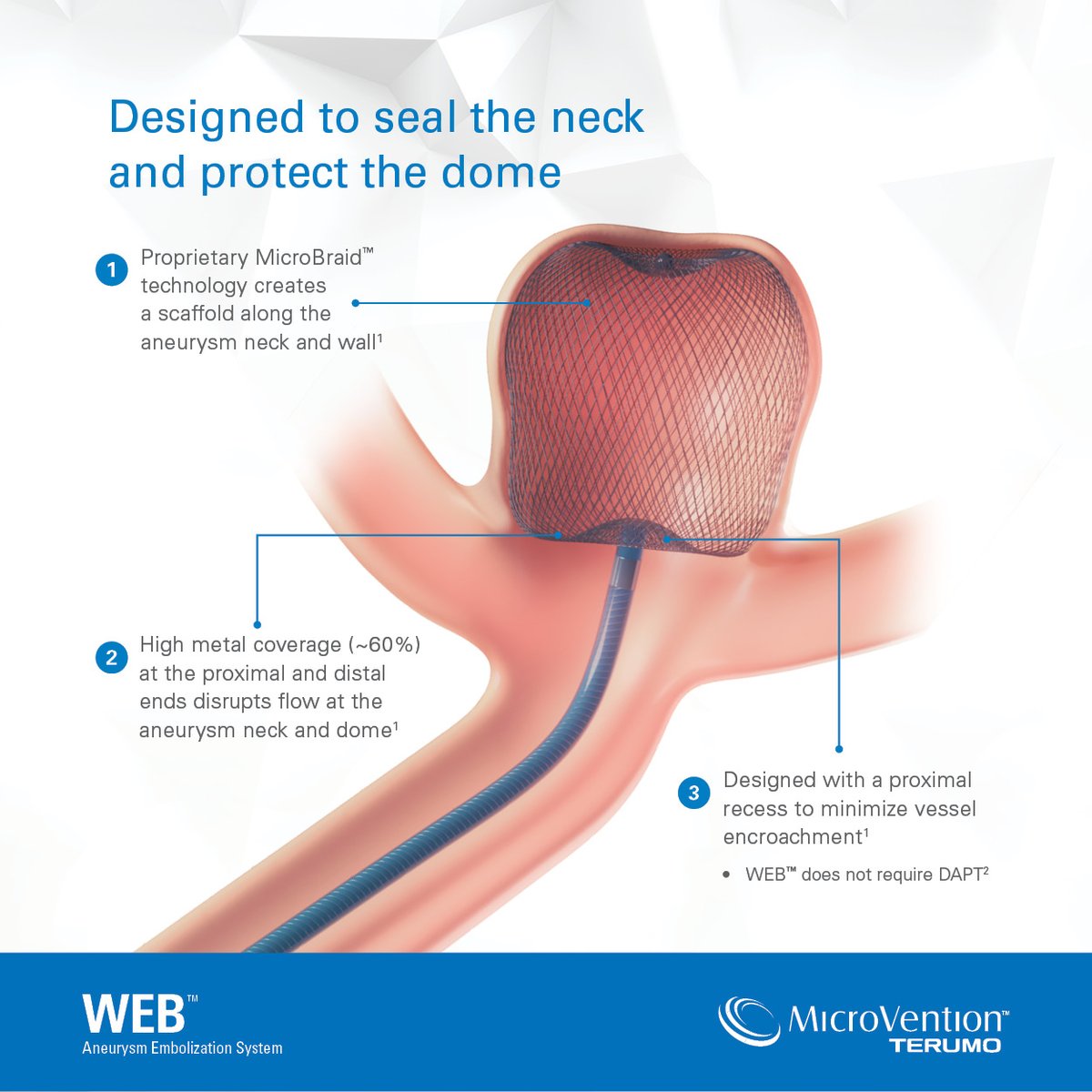 terumoneuro's tweet photo. Designed to seal the neck and protect the dome of aneurysms, the WEB™ Device is now available in two new sizes: 6x2 and 7x2. Learn more about the WEB™ device by speaking to your local #MicroVention sales representative.
#WEBdevice #OneAndDone #neuroendovascular #neurointervention #neuroradiology #neurotwitter
References:
1. Data on file
2. Spelle L, Liebig T. Neuroradiol J. 2014;27:369.