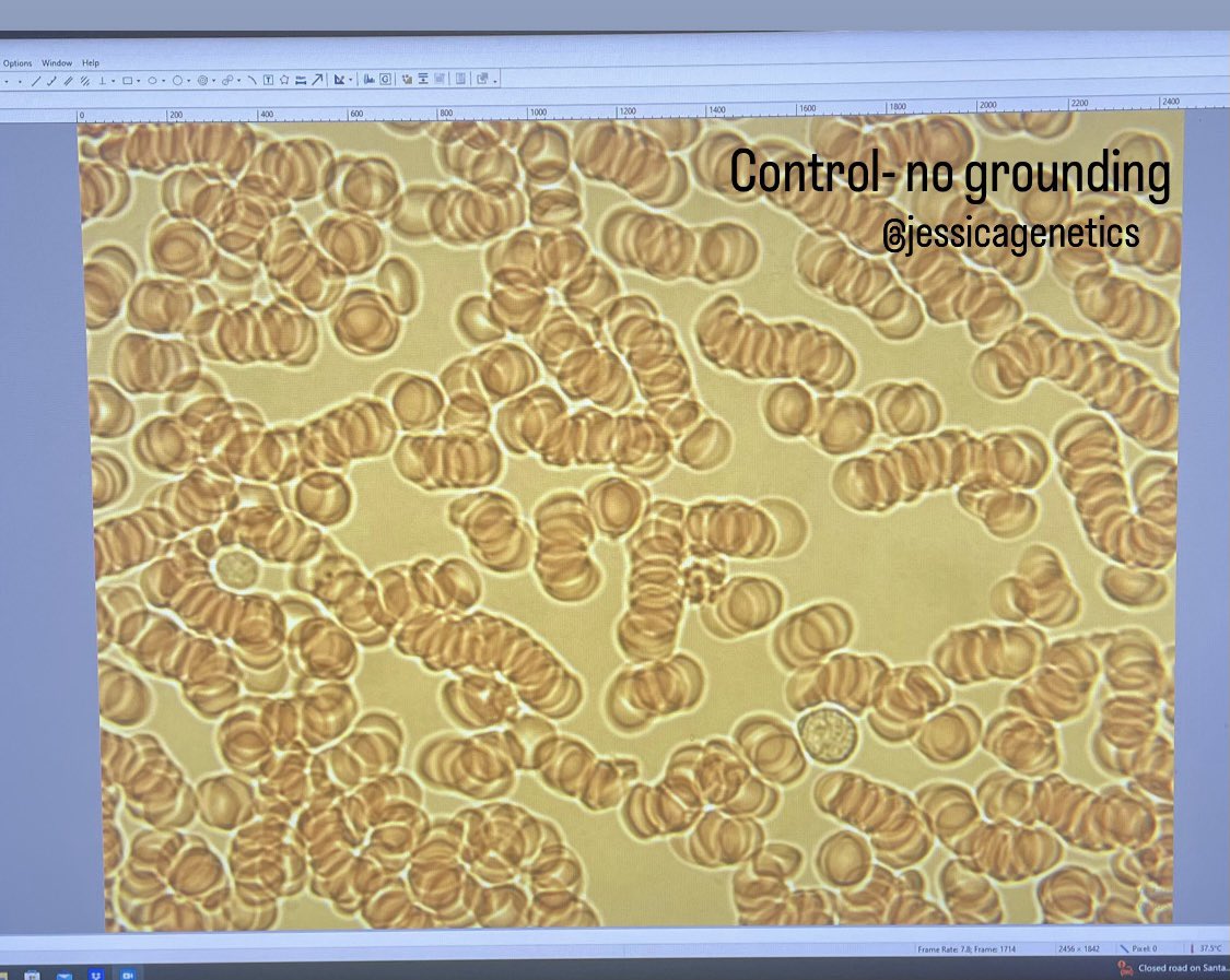 JessicaGenetics's tweet image. My conclusions:

1. Walking/circulation isn’t causing the effect we’re seeing
2. Just the act of going outside in the shade seems to offer some benefit 
3. 5 minutes of grounding barefoot on grass is enough to have an effect