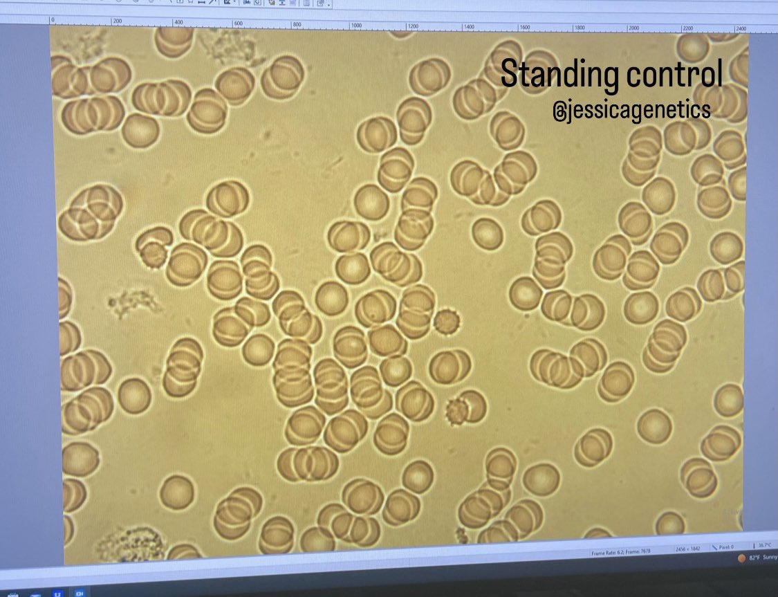 JessicaGenetics's tweet image. My conclusions:

1. Walking/circulation isn’t causing the effect we’re seeing
2. Just the act of going outside in the shade seems to offer some benefit 
3. 5 minutes of grounding barefoot on grass is enough to have an effect