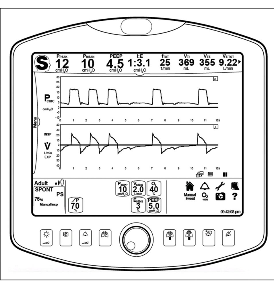LeslieMegom's tweet photo. 🔰Destete o no destete⁉️: Guía práctica centrada en el paciente sobre el Weaning  del ventilador🛌
⚠️¿Qué hacer cuando fracasa la extubación? 
👇👇👇👇👇👇
https://t.co/NRQUYVuluU
🗝🔓
https://t.co/S8OQ2Uikwl https://t.co/QcopU4BxaB