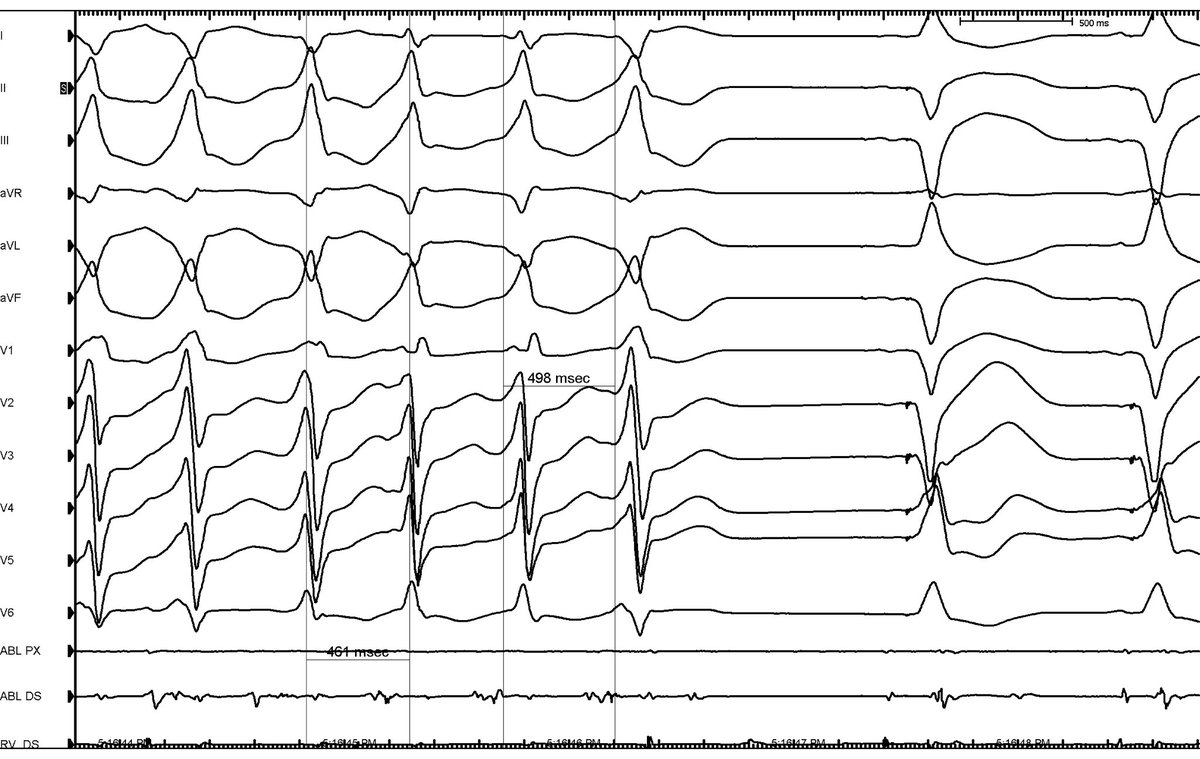 Fergie J. Losiniecki, MD, FACC, FHRS tweet media