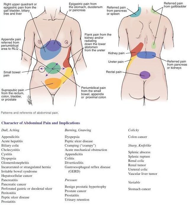 Lumbar Pain Chart
