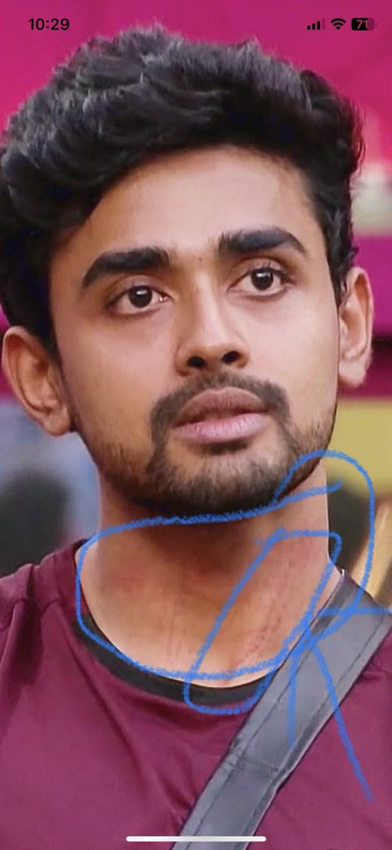 krish_fx's tweet image. @adireddyfantasy did you see this ? Did you ever supported this man like pp and yawar ? If this happens to pp and yawar they could hv made crying sympathy out of it #BiggBossTelugu7 #bigboss7telugu @iamnagarjuna @DisneyPlus #gauth