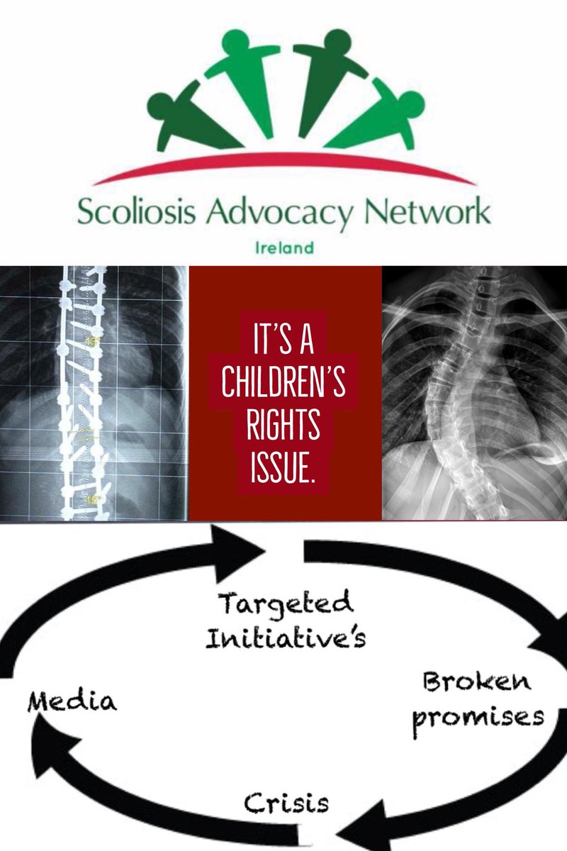 scolionetwork's tweet photo. Today we listen to the Health Committee to see if any light can be shed on the care of children with #scoliosis #spinabifida 

This is a very stressful time for many of our families. 

CHI Crumlin review published - Parents received calls late yesterday eve re child involvement https://t.co/aXk13VzgyK