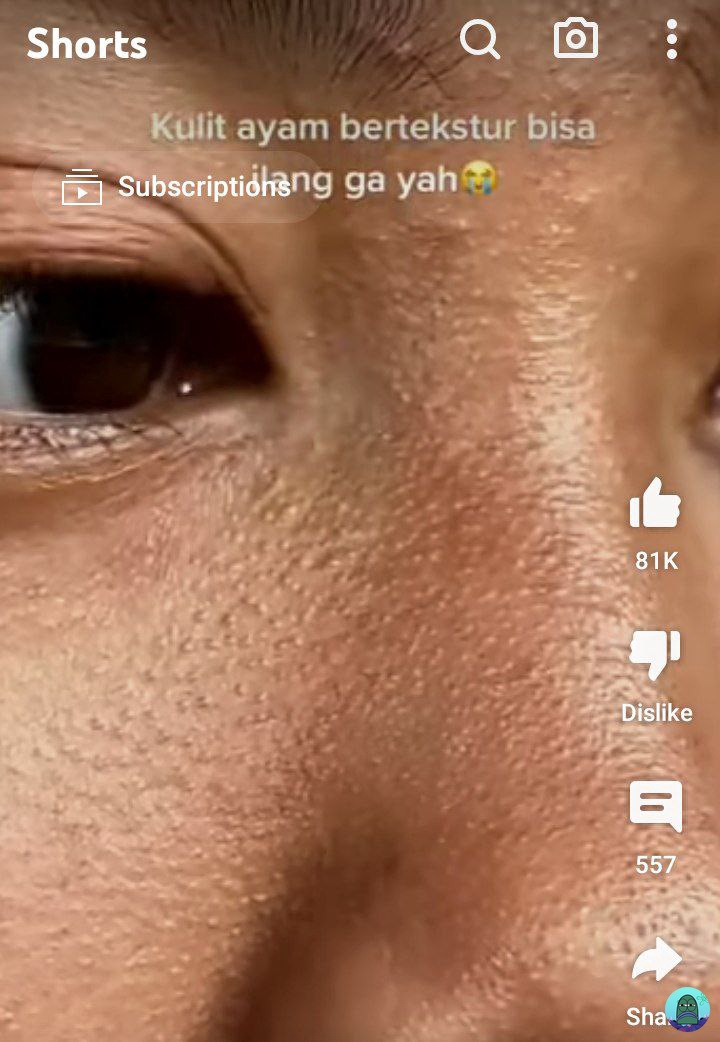 Tanyarl 💚 tweet media