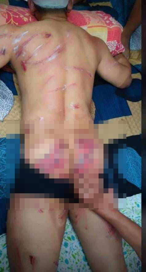 lanchenba_salm's tweet photo. Security Forces have been using excessive power to the students.

This is the Violation of Human Rights and it also violates students fundamental rights.

@UNHumanRights @UN
@SCofInd @INDIAHR_offic 
@IndEditorsGuild @BBCWorld

#ManipurViolence
#GenevaWithManipur
#G20 #G20INDIA https://t.co/08RoGT9Xw7
