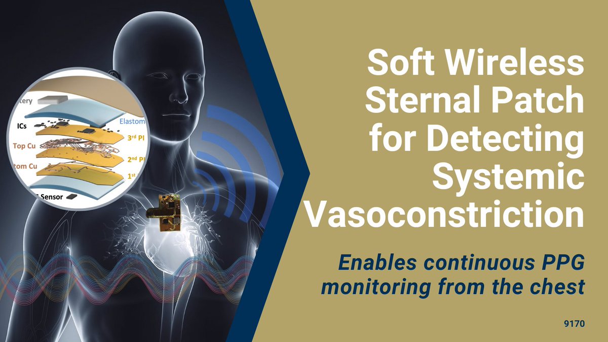 GaTechOTL's tweet photo. #AvailableForLicensing: Wireless, soft #sternalpatch includes integrated skin-like, photolithographically patterned electronics specifically tuned to continuously measure #vasoconstriction from the sternum.
#Photoplethysmography #sleepapnea
@MEGeorgiaTech
https://t.co/TjZtlLxbOd https://t.co/aZNvDwZYDS