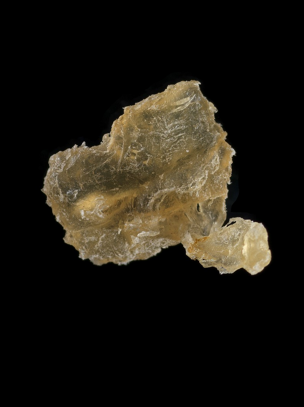 kindomproject's tweet photo. ⚓️ Many of us take our travels for granted, but for some objects, the journey is much more profound. Boston-based artist Evelyn Rydz takes us on a journey through her coastal field studies and microscopy to create a visually captivating portrait on objects from the ocean. https://t.co/EW9cETk60T