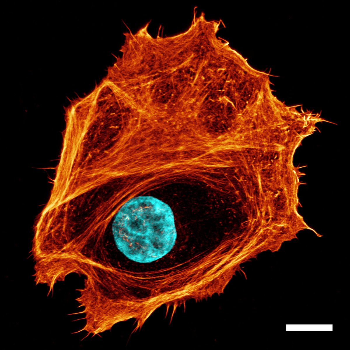 Das Symposium #PhysicsofCancer vom 4.-6. Oktober an der #UniLeipzig befasst sich mit den mechanischen und dynamischen Eigenschaften von #Krebs-Zellen und deren Rolle in #Tumoren. Zum 14. Mal tauschen sich Expert:innen über die neuesten Entwicklungen aus: uni-leipzig.de/newsdetail/art…